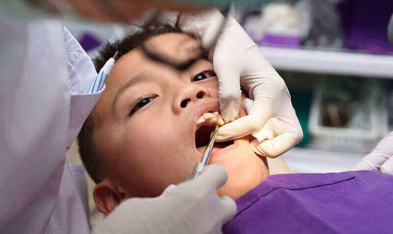 Tooth Extractions Vancouver